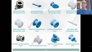 Otitis Media with Effusion OME Part2 [upl. by Finnie]