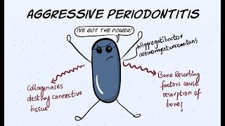 Aggressive Periodontitis Part 1  Etiology and Pathogenesis [upl. by Meggie]