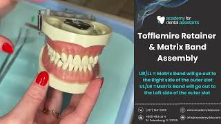 Tofflemire Retainer and Matrix Band Assembly  Academy for Dental Assistants [upl. by Convery]