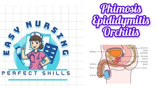 Phimosis  Epididymitis  Orchitis 4th sem [upl. by Shippee302]