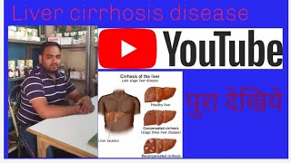 Liver cirrhosis kya hai kya Karan Se Hota Hai iska diagnosis kya hai Deepakpharmacist1992 [upl. by Devondra]