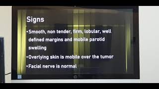 Pleomorphic adenoma Parotid gland Part 1 Patient teaching programme Hindi [upl. by Notsnarc518]