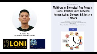 MultiOrgan Biological Age Reveals Causal Relationships Between Human AgingDiseaseampLifestyle Factors [upl. by Anairda]