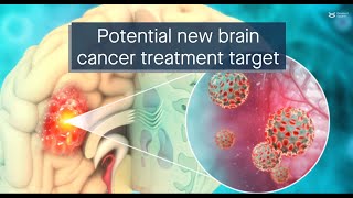 The FAKZDHHC5 axis a potential new treatment target for glioblastoma [upl. by Herc]