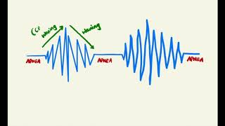 Answer  Medicine Quiz No1  CHEYNESTOKES BREATHING [upl. by Ardnassak598]