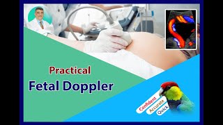 Practical Obstetric Doppler  Ductus Venosus [upl. by Naltiak]