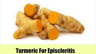 9 Top Natural Cures For Episcleritis [upl. by Llenwad398]