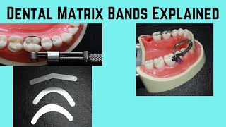 What is a dental matrix band [upl. by Mcmaster]