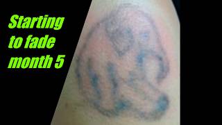 thINK Tattoo Removal Cream 2018 [upl. by Nnaael506]