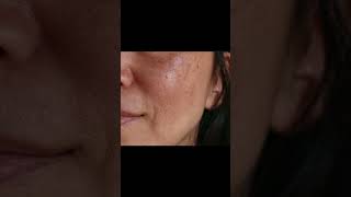 Honey face mask best for All skin type selfcare skincare [upl. by Aleira]