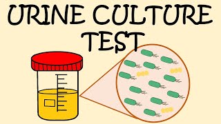 URINE CULTURE TEST  HOW TO COLLECT URINE SAMPLE [upl. by Oates]