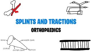 SPLINTS AND TRACTIONS  ORTHOPAEDICS  MED VIDS MADE SIMPLE [upl. by Natsirt]