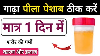 dark yellow urine reason  पेशाब का रंग  Urine color changed Know why peela peshab aana dr tarun [upl. by Naleek]