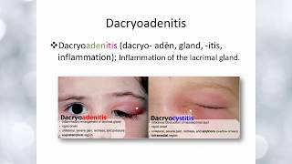 Elbromboly Basic ophthalmology IC Lacrimal apparatus Lacrimal gland amp its diseases [upl. by Arada764]