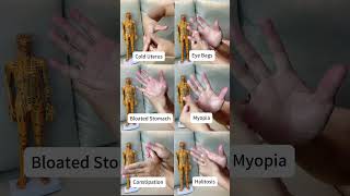 6 Effective Acupressure Points on Your Hand for Healthshorts [upl. by Enomes]