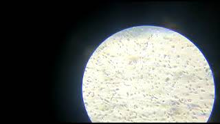 seman analysis microscopic examination [upl. by Nesline834]