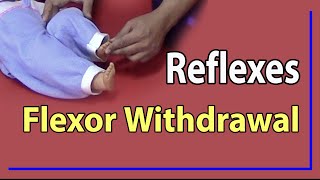 01 Flexor Withdrawal Reflex [upl. by Whang120]